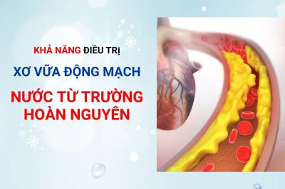 Khả năng điều trị xơ vữa động mạnh của nước từ trường hoàn nguyên
